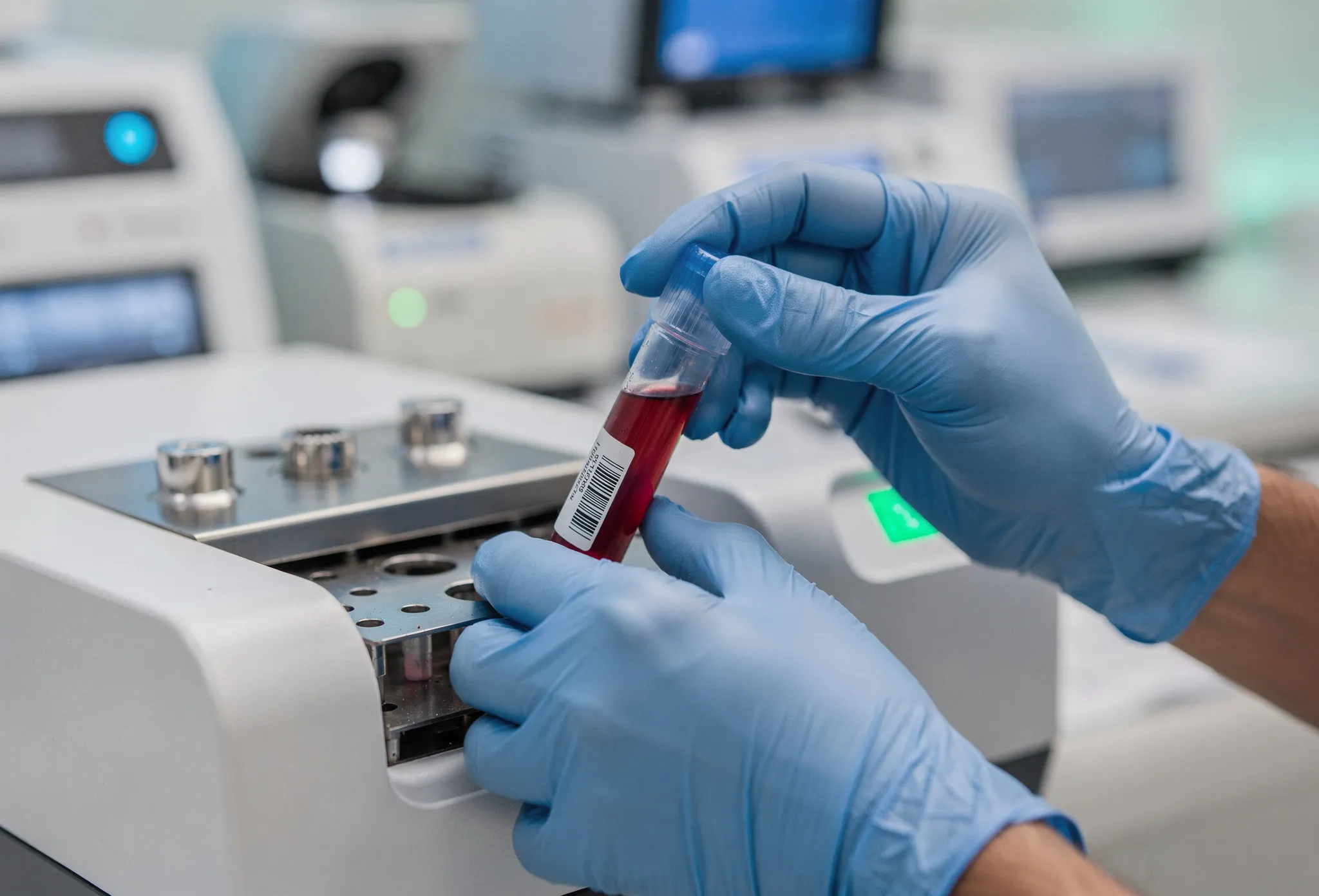 Food sensitivity testing